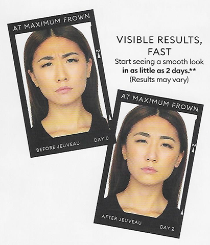jeuveau botox miami