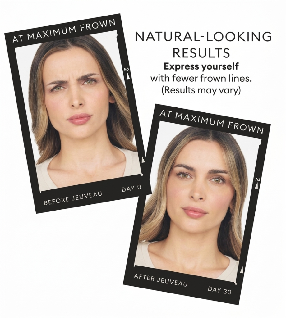 botox miami medial spa