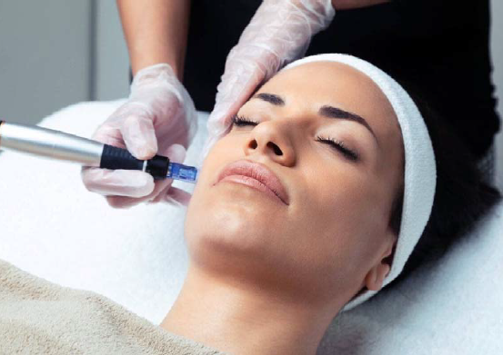 micropuncion-micronedding miami colageno piel medical spa